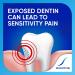 Sensodyne Extra Whitening Toothpaste - 4oz | Cavity Prevention & Sensitive Teeth Whitening - Buy Online on GoSupps.com