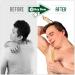 RENOOK Bamboo Wooden Back Scratcher 16.5'' - Instant Itch Relief, Perfect Gift for Loved Ones - Buy Online on GoSupps.com