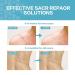 Medical Grade Silicone Scar Sheets Roll - 1.6 x 120 inches, 3M Brand - For C-Section, Surgery, Burn, Keloid, Acne - Reusable & Washable - Scar Removal Treatment - Buy Online on GoSupps.com