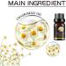 Marronie Oil for Varicose Veins Marronie Chamomile Essential Oil for Varicose Veins 1/3/5 Pack Marronie Oil Varicose Veins (3pcs) - Buy Online on GoSupps.com