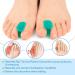 16 Pack Silicone Toe Separator for Bunion Correction - Soft, Flexible, and Skin-Friendly Foot Care Tool - Buy Online on GoSupps.com