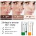 Anti Acne Face Cream Dark Spot Remover for Face Spot Cream for Acne Treatment and Spot Treatment Age Spot Remover for Face Rapid Action Spot Cream for Blackheads and Acne Prone Skin - Buy Online on GoSupps.com