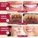 SP-6 Probiotics Ultra Whitening Toothpaste - Deep Cleaning & Fresh Breath 2PCS - Brighten Teeth & Remove Stains - Buy Online on GoSupps.com