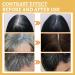 S rum pour la Croissance des Cheveux Hair Growth Serum Hair Lotion Huile Naturelle pour la Croissance des Cheveux Nourrir les Cheveux et la Peau 30ML - Buy Online on GoSupps.com
