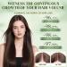 Alphainfuse Hair Regrowth System Alpha Infuse Repousse Cheveux Micro Infusion system Syst me de Repousse des Cheveux Densifie et Renforce les cheveux d s la Racine (5 ml x 6) - Buy Online on GoSupps.com