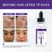 Tranexamic Acid Serum Tranexamic Acid Face Serum Brightening Serum for Face Dark Spot Remover for Face Txa Dark Spot Correcting Serum Reduces Hyperpigmentation Anti Wrinkle Hydrating - Buy Online on GoSupps.com