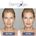 Dark Spot Corrector Cream - Fades & Repairs Sunspots, Acne Scars, Age Spots, and Freckles for Face & Body - Safe for All Skin Types - Buy Online on GoSupps.com