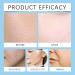 Gla-Mory Micro-Infusion System for Lips Gla-Mory Micro System for Face Hyaluronic Acid Serum Gla-Moryfacial System with Hydrating Serum Smooth Face Serum for Women Skincare Anti Aging Serum for Face - Buy Online on GoSupps.com