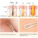 ME MAXEQUIP Blackhead Remover Pimple Popper Blemish Comedone Extractor Acne Tool Pimple Spot Popper Komedon Double Side Soft Touch and No-Slip Skincare for Whitehead Removal Stainless Steel - Buy Online on GoSupps.com
