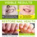Pr vention des mordants | Solution de morsure ongles de 7 ml | Amer Natural Stop Suck Habit | Arr t naturel Sucking Habit Care de sant portable pour les jeunes adultes TEENS BITERS TODDLER - Buy Online on GoSupps.com