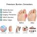 Women s Slip-Toe Sandals - Orthopedic Summer Roman Style Flat Shell Beach Sandals for Flat Feet & Plantar Fasciitis (25.5cm White) - International Shipping Available - Buy Online on GoSupps.com