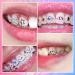 LFLIFENG Tooth Gems - 8 Styles of Stunning Tooth Jewelry Set for Parties & Festivals | Style 4 - Buy Online on GoSupps.com