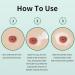 Stoma Powder - Medical Protective Skin Barrier Powder for Ostomy Care | 1oz (2 Bottles) - Best Supplies for Skin Protection - Buy Online on GoSupps.com