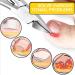 Thick Toenail Clipper Ingrown Toenail Trimmer Curved Strong Nail Cutter for Ingrown Toenail Treatment - Buy Online on GoSupps.com