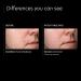 PCA SKIN Acne Spot Treatment Gel - 2% Salicylic Acid for Breakouts & Dark Spots - 1 fl oz - Buy Online on GoSupps.com