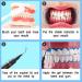 Luckin Smile 10PCs 3ml Gum Protection Gel - Tooth Whitening & Dental Care for Home & Practice - Buy Online on GoSupps.com