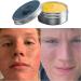 Shop Norse Organics for Acne Solutions & Muscle Balm - Kill Redness & Achieve Clear Skin Worldwide - Buy Online on GoSupps.com