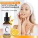 Memonotry Vitamin C Serum with Hyaluronic Acid - Anti Aging, Pore Minimizer, Acne Scar & Dark Spot Remover - 30.00 ml (Pack of 1) - Buy Online on GoSupps.com