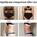 Losing Weight Patches - Rapid Slimming & Detox Plaster for Fat Burning - 5 Pieces | Appetite Suppression - Buy Online on GoSupps.com