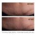 StriVectin Anti-Wrinkle SD Advanced Plus - Intensive Moisturizing Concentrate for Wrinkles & Stretch Marks, 2 Fl Oz - Buy Online on GoSupps.com