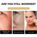 Snail Mucin Serum Snail Mucin Essence Snail Mucin Moisturiser Snail Serum Hydrating Serum for Face With Snail Secretion Filtrate for Dull & Damaged Skin For Lighten Dark Spots and Fine Lines - Buy Online on GoSupps.com