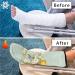 Hummingbird Flower Leg Cast Covers | Reusable & Removable Elastic Protection Sleeve for Small Leg Casts - Shop Internationally - Buy Online on GoSupps.com