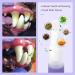 Pet Oral Repair Gel Pet Oral Restorative Gel Pet Oral Restoration Whitening Gel Pet Teeth Cleaning Pen Pet Breath Freshener Gel Care Cleaner No Brushing Pet Oral Care 6pcs - Buy Online on GoSupps.com