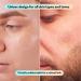 LE GUSHE K-BEAUTY Hydrocolloid Pimple Patches - 78 Invisible Acne Spot Stickers for Glowing Skin | Premium Korean Skin Care - Buy Online on GoSupps.com