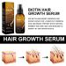 Biotin Hair Growth Serum Hair Growth Spray Anti-Hair Loss Hair Care Oil Nourishes Hair & Scalp Hair Growth Oil for Women & Men Prevent Hair Loss & Thinning 20ml - Buy Online on GoSupps.com