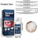5-Pack Tooth Repair Kit: 4Pcs Dental Tools, 1Pcs 30ml Repair Beads - Temporary Fixing Missing Broken Tooth Set - Buy Online on GoSupps.com