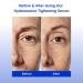 Michael Marcus Hydromarine Tightening Day and Night Serum Moisturizing Lifting & Recovery Serum for Women & Men Skin Firmness and Renewal - Skin Lifting Day & Night Serum (60ml / 2oz) Hydromarine Tightening Serum - Buy Online on GoSupps.com