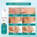3Pcs Medical Grade Scar Remove Spray - Advanced Acne Scar Treatment - Buy Online on GoSupps.com