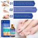 Extra Strength Nail Fungus Treatment - Restoring Healthy Nails 1 Fl Oz (Pack of 1) - Buy Online on GoSupps.com