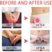 Aizuoni Anti Itch Cream for Women - Soothing and Refreshing Itching Cream - Anti Itch Ointment for Relief Dryness Itching Burning Redness Itch Relief - Buy Online on GoSupps.com