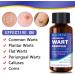 Wart Remover Liquid - Maximum Strength Natural Formula for Rapid Plantar & Common Warts - Safe & Effective for All Body Warts - Buy Online on GoSupps.com
