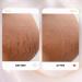 S1 Stretch Mark Cream 150ml - Lightweight Pregnancy & Postpartum Stretch Mark Solution for All Skin Types - Buy Online on GoSupps.com