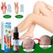 2 Pieces Veinhealing Varicose Vein Treatment Spray | Soothing Relief for Legs | Effective Varicose Vein Spray - Buy Online on GoSupps.com