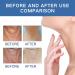Neck Firming Serum Rapid Lift Advanced Neck Serum Neck Firming Cream Black Neck Remover Neck Lift Skin Tightening for Fine Lines and Wrinkles on the Neck Repair Sagging Skin - Buy Online on GoSupps.com