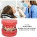 Orthodontic Demonstration Model | Professional Dental Model with Metal Wires & Brackets for Learning | International Shipping Available - Buy Online on GoSupps.com