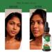 Relaxcation Pure Walnut Oil Cold Pressed Unrefined Plant Oil for Face Hair Nails & Body | Natural Carrier for Blends Glow Routines & Daily Use | Vegan & Organic (4 oz) 4 Fl Oz (Pack of 1) - Buy Online on GoSupps.com
