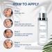 Dark Spot Remover Serum for Face, Body & Inner Thighs | Niacinamide & Salicylic Acid | Discoloration Corrector & Acne Treatment - Buy Online on GoSupps.com