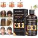 Anti-Hair Loss Shampoo 220mL - Effective Hair Growth Solution for Thinning & Breakage - Stop Hair Loss & Promote Fast Growth - Men & Women Treatment - Buy Online on GoSupps.com