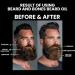 30ml Men's Beard Oil | Natural Jojoba Avocado & Castor Oil | Black Skull Scented Oil | 6 Fragrance Options - Woodland Elixir - Buy Online on GoSupps.com