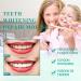 Probiotics Bright Whitening Teeth Mousse | 2024 Herbal Oral Repair Treatment | Deep Stain Removal Foam (2PCs) - Buy Online on GoSupps.com