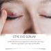 Stye Eye Treatment & Chalazion Remover | Eye Relief Serum & Gentle Lash Cleanser - Fast International Shipping - Buy Online on GoSupps.com