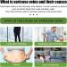 Varicose Veins Treatment Spray - Expert Relief for Tired Legs | Enhance Blood Circulation | 2-Piece Set - Buy Online on GoSupps.com