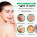Genryu Aloe Vera Wart Eliminator Soap 100g (2 PC) - Sulfate Free, Ultra Moisturising - Buy Online on GoSupps.com