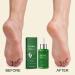 Foot Lotion | Heel Moisturizing Lotion 30ml | Intensive Foot Moisturizer Daily After-Shower Care for Dry Winter Climates and Travel - Buy Online on GoSupps.com