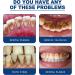 Effective Tartar & Yellowed Teeth Mouth Spray - Long-Lasting Freshness | International Shipping - Buy Online on GoSupps.com