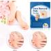 MQUPIN Corn Remover Pads Wart Remover Pads Foot Corn Remover Pads Plantar Wart Removal Corn Callus Remover Penetrates and Removes Common and Plantar Warts with Hole Callus Stops Wart Regrowth (24 PCS) - Buy Online on GoSupps.com